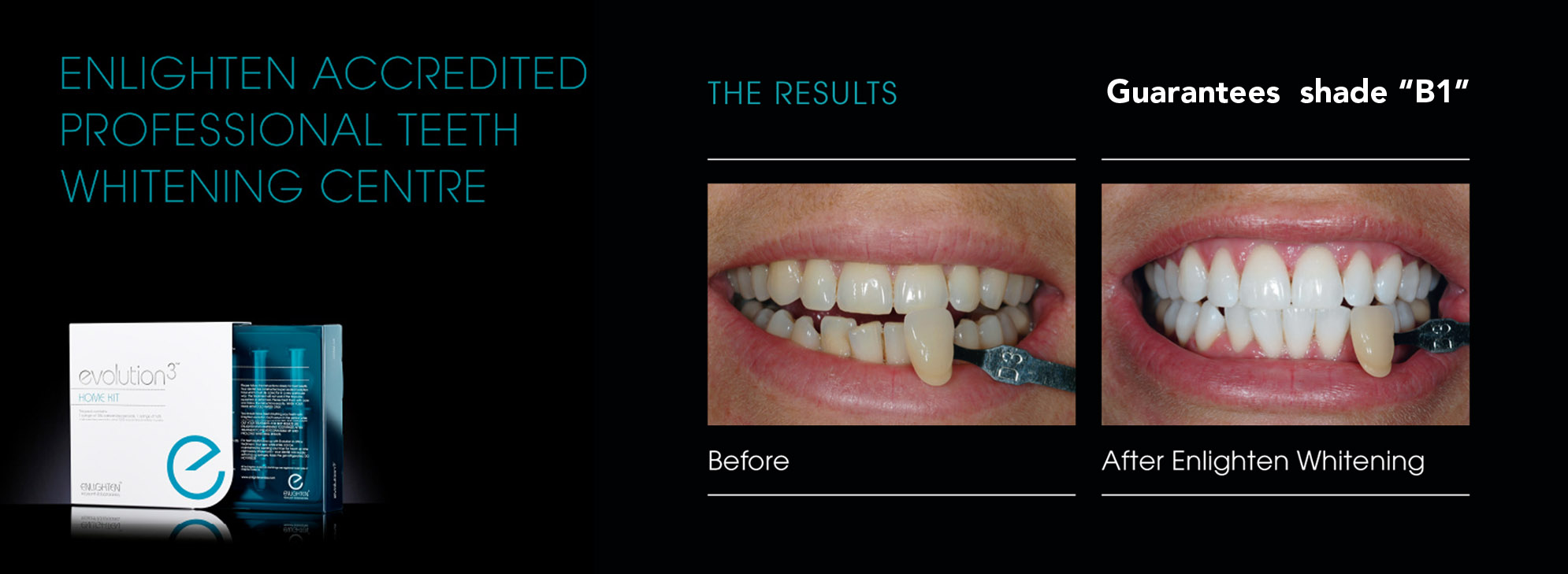 Enlighten deep bleaching teeth whitening system