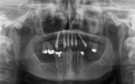 Screenshot 2020-08-06 at 11.06.43