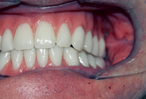 Screenshot 2020-08-06 at 10.59.25