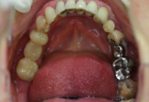 Cosmetic dentistry - before