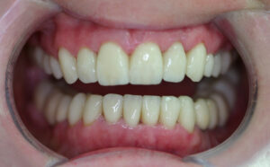 Cosmetic Dentistry - case study - after