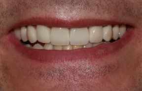 cosmetic dentistry