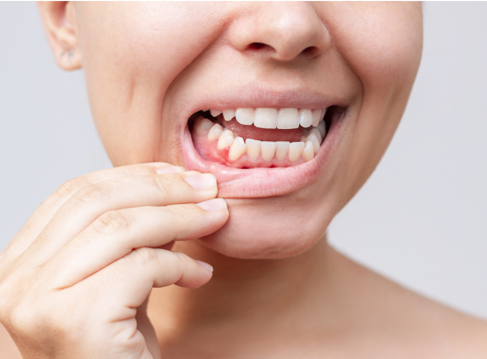 gum_disease-relation_to_diabetes