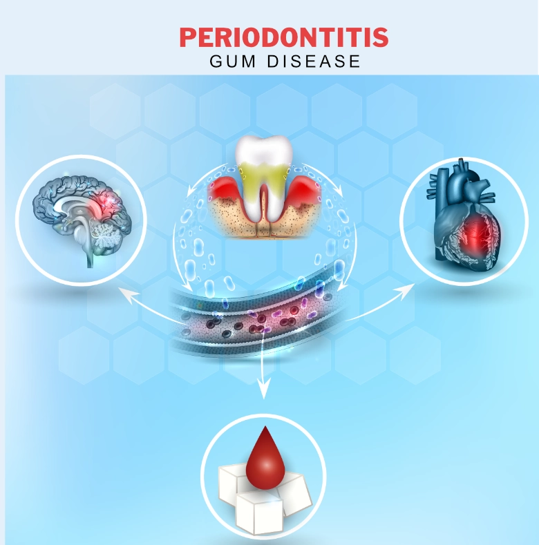 gum_disease_danger_heart_brain